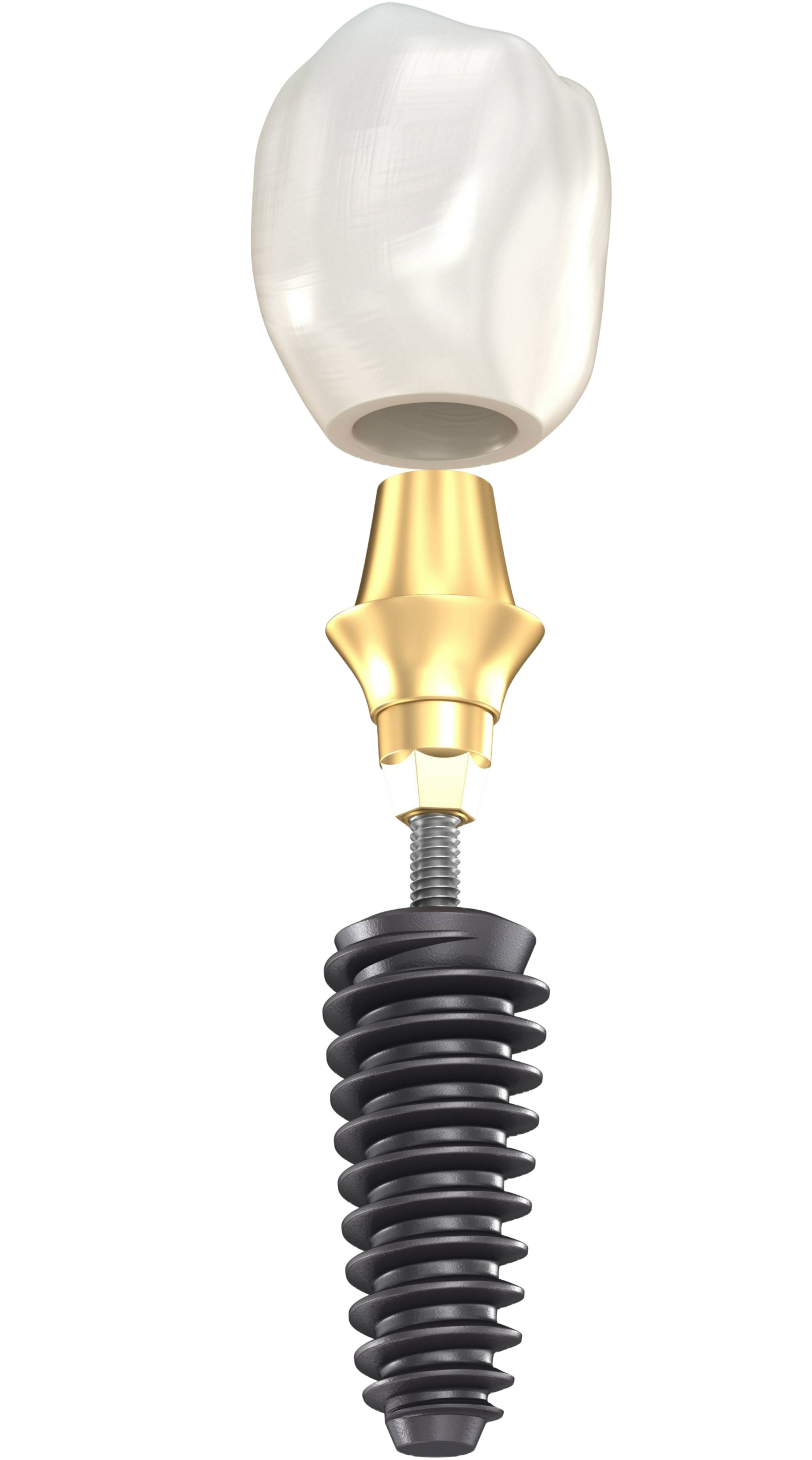 The parts of a dental implant, crown, abutment and titanium post
