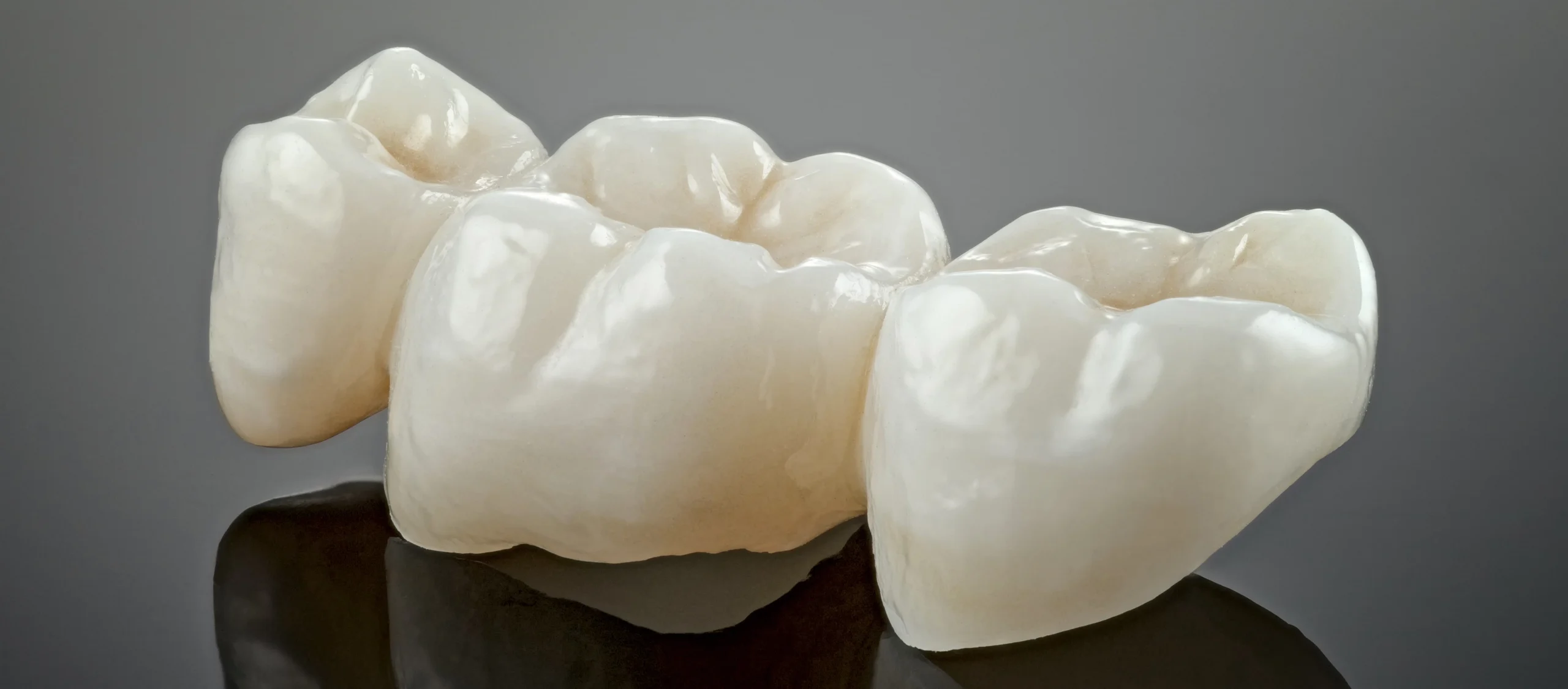 Dental bridges at North Harrow Dental in Harrow