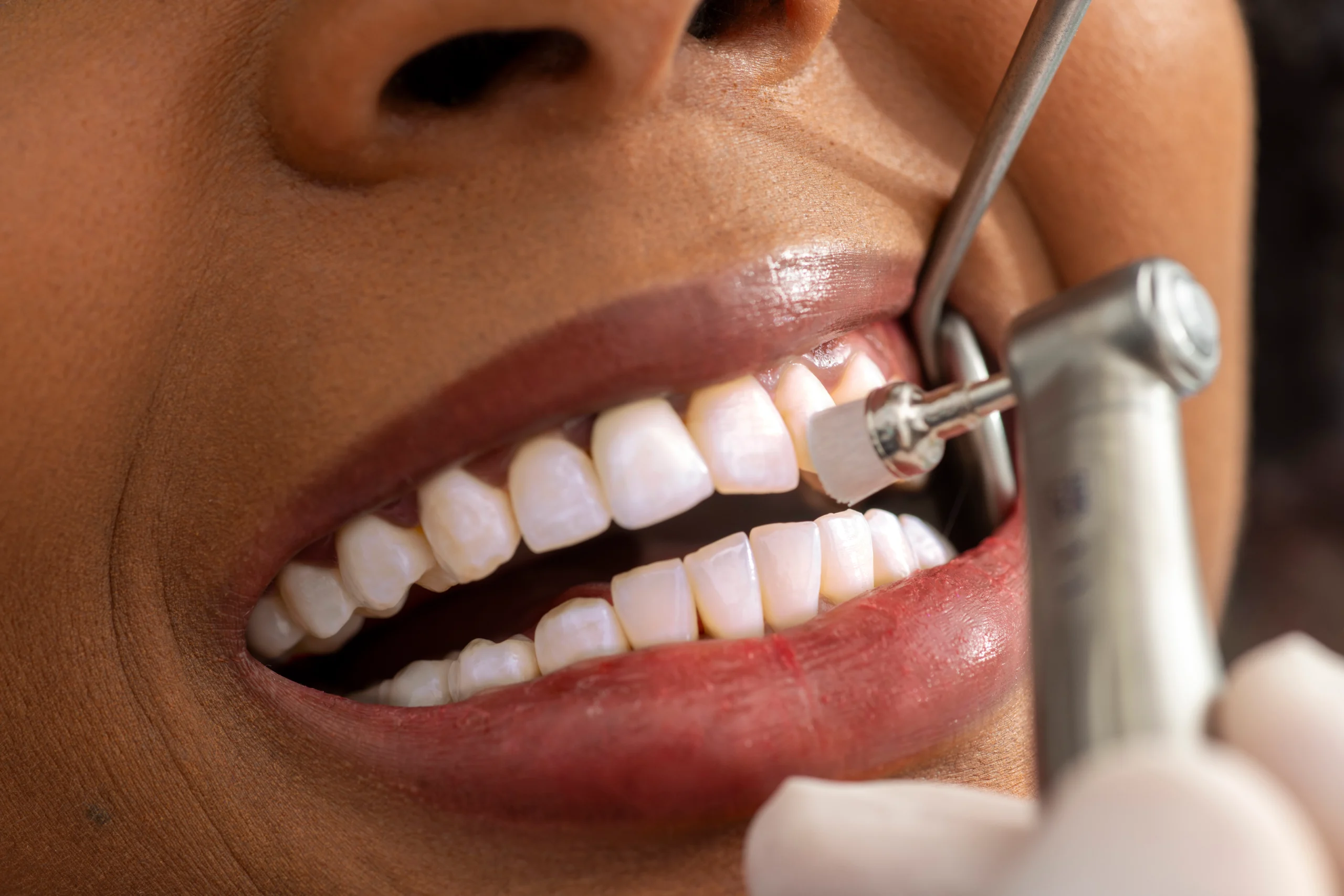 Understanding the stages of gum disease at North Harrow Dental