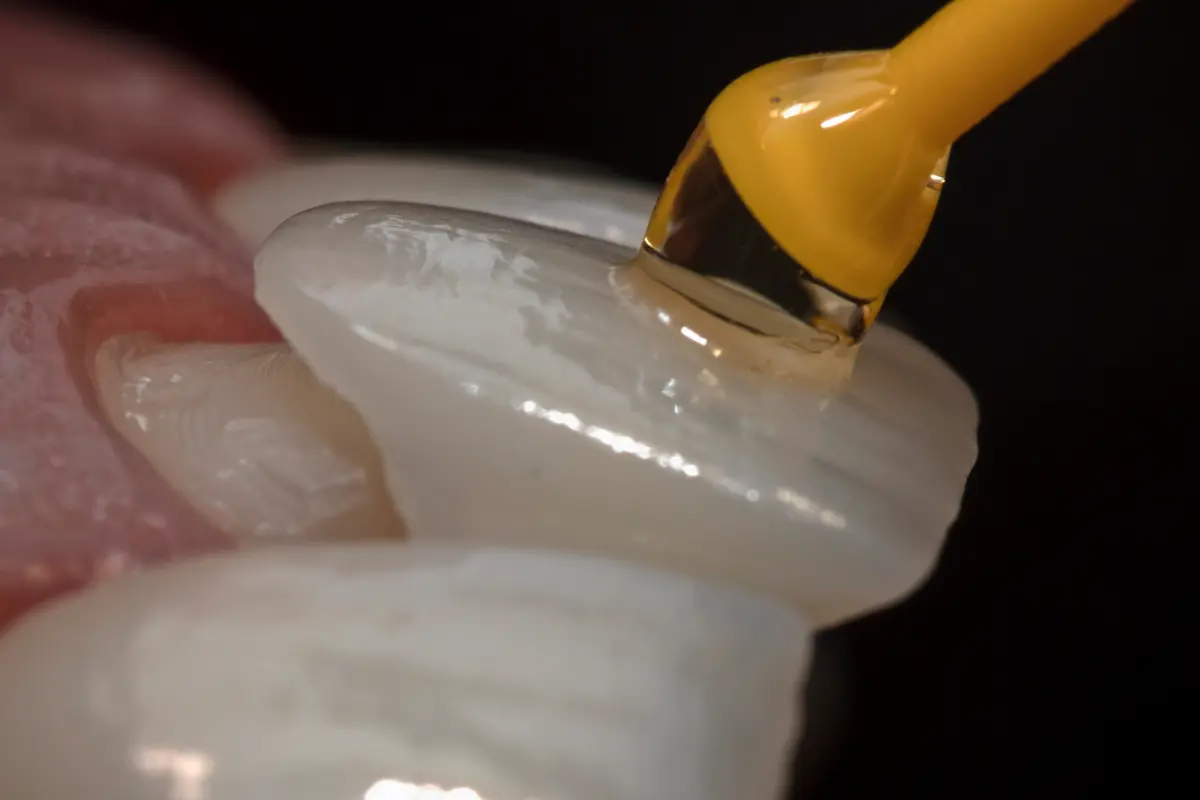 Porcelain veneers treatment at North Harrow Dental in Harrow
